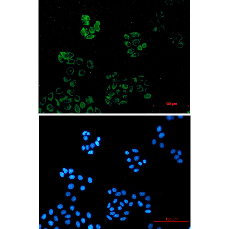 IRAK4 Rabbit mAb
